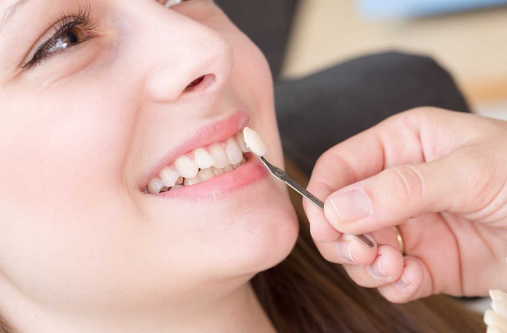 Who can't use dental veneers?