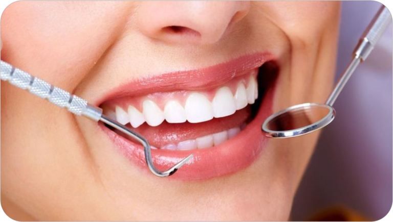 The difference between laminate and dental veneers