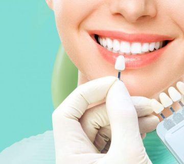 Who is not suitable for dental laminate?