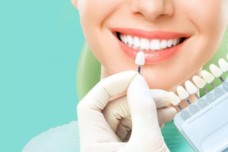 Who is not suitable for dental laminate?