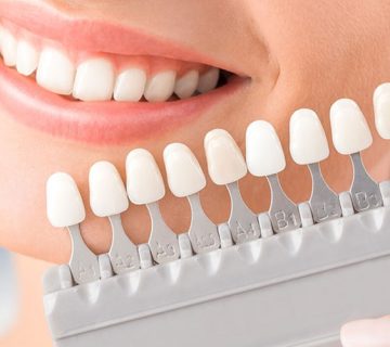 Necessary care after dental lamination