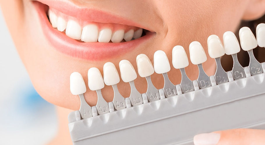 Necessary care after dental lamination