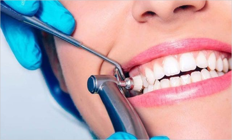 Care after composite