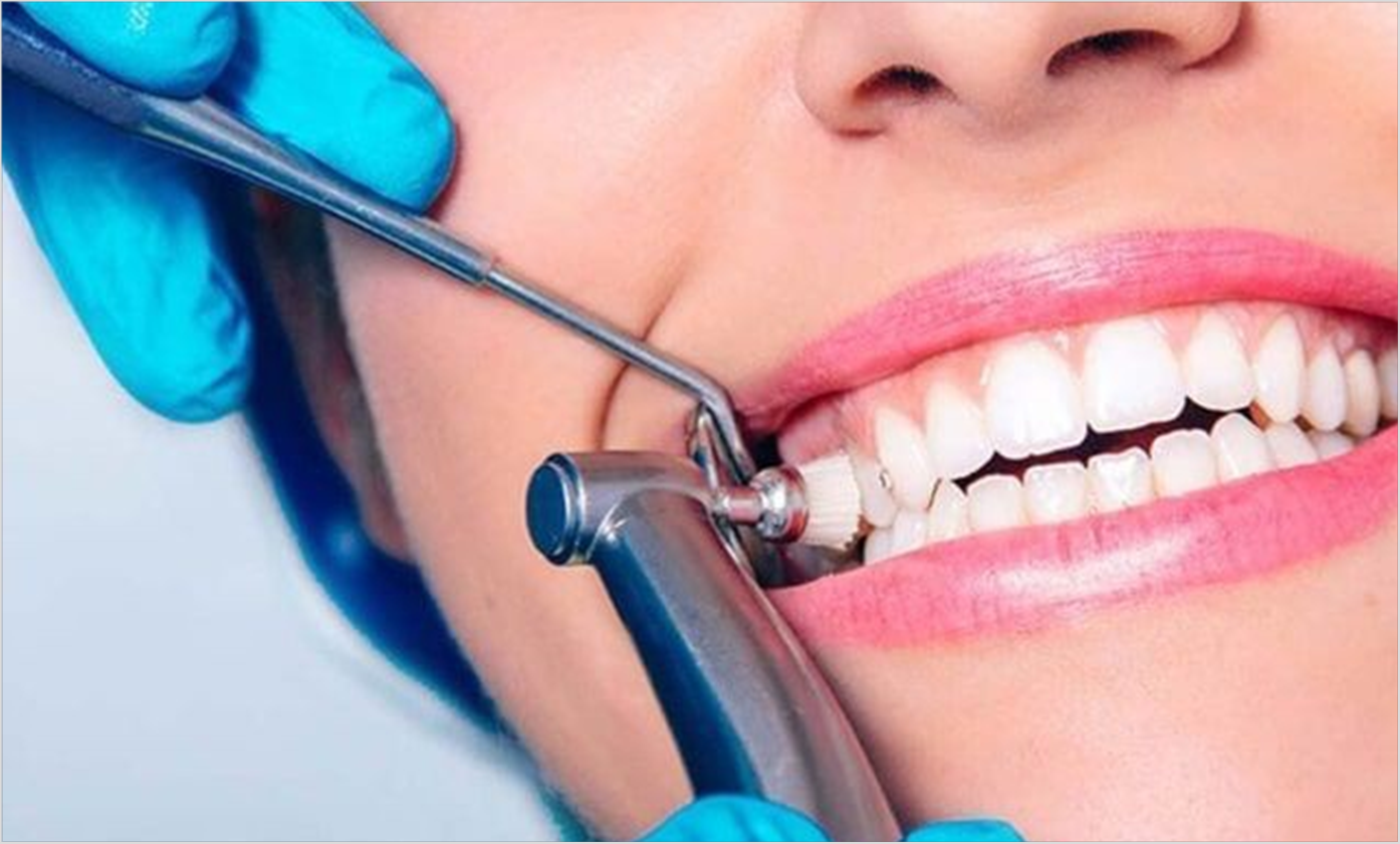 Care after composite
