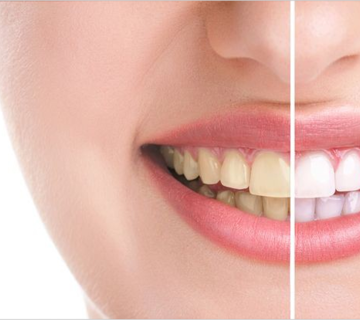 Is it possible to change the composite color?