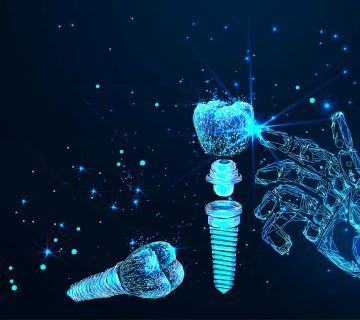 What are the advantages of digital dental implants?