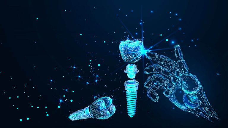 What are the advantages of digital dental implants?