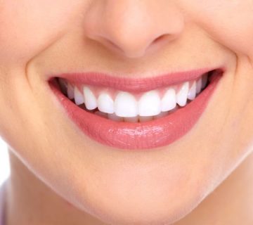 What are the consequences of late dental implants?