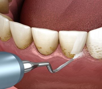 How often should the crime be done?