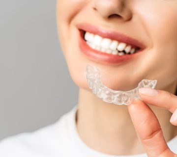 Transparent orthodontics (invisible)