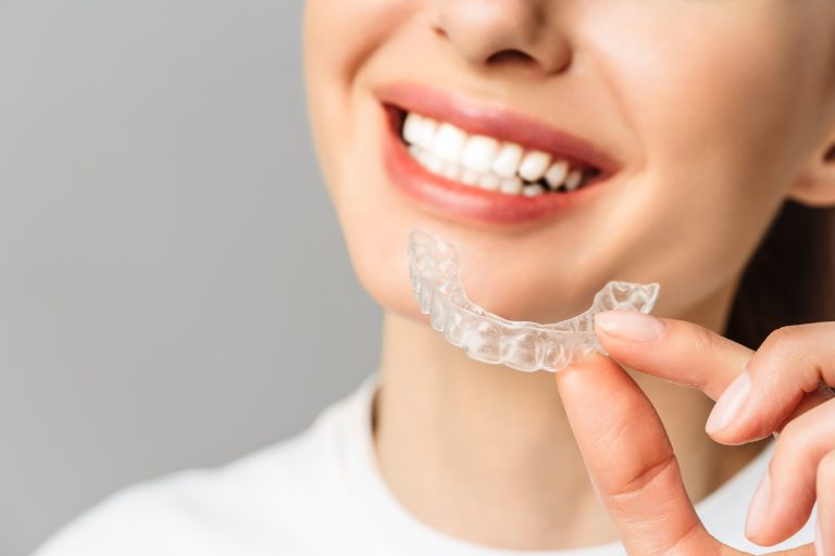 Transparent orthodontics (invisible)