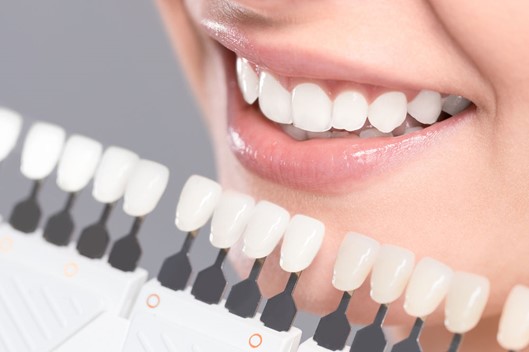 Types of teeth whitening methods