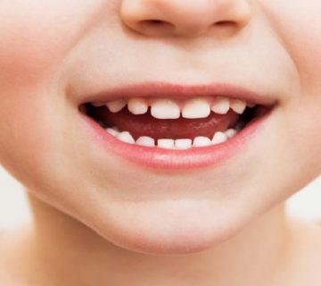 Stages of growth and development of milk teeth