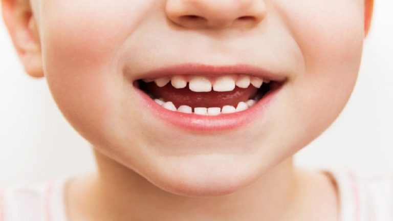 Stages of growth and development of milk teeth