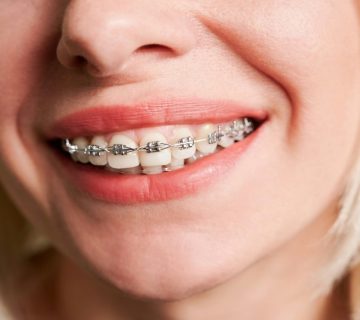 Orthodontics