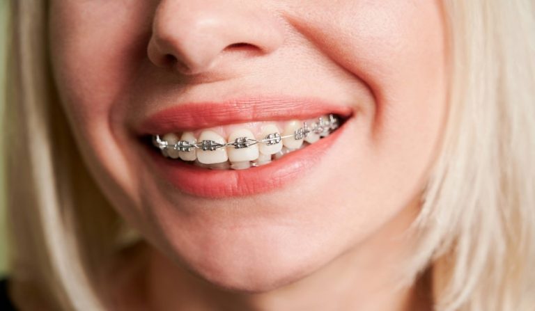 Orthodontics