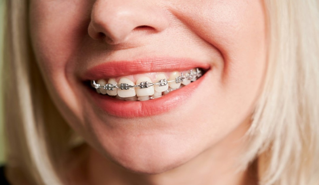 Orthodontics