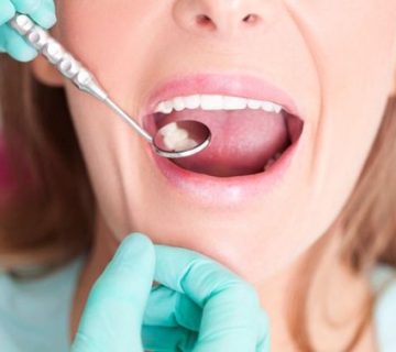 The gap between the teeth