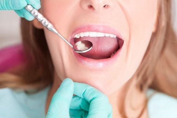 The gap between the teeth