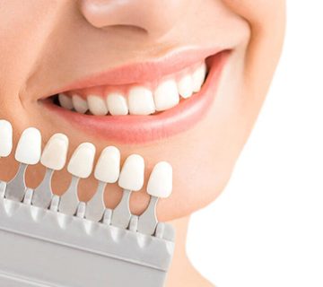 7 main reasons why we should laminate teeth