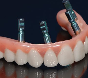 zirconia prosthesis