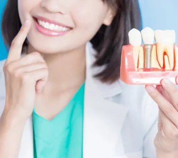 Implants and natural teeth