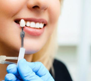 Implants and natural teeth