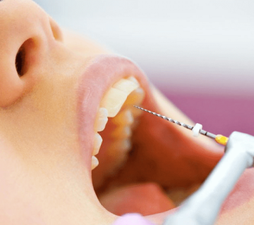 Dental denervation and root canal treatment