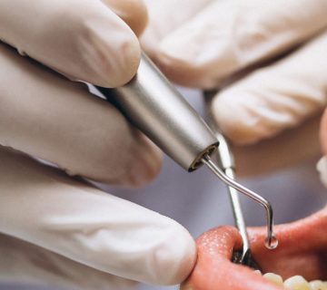 Anesthetic injection