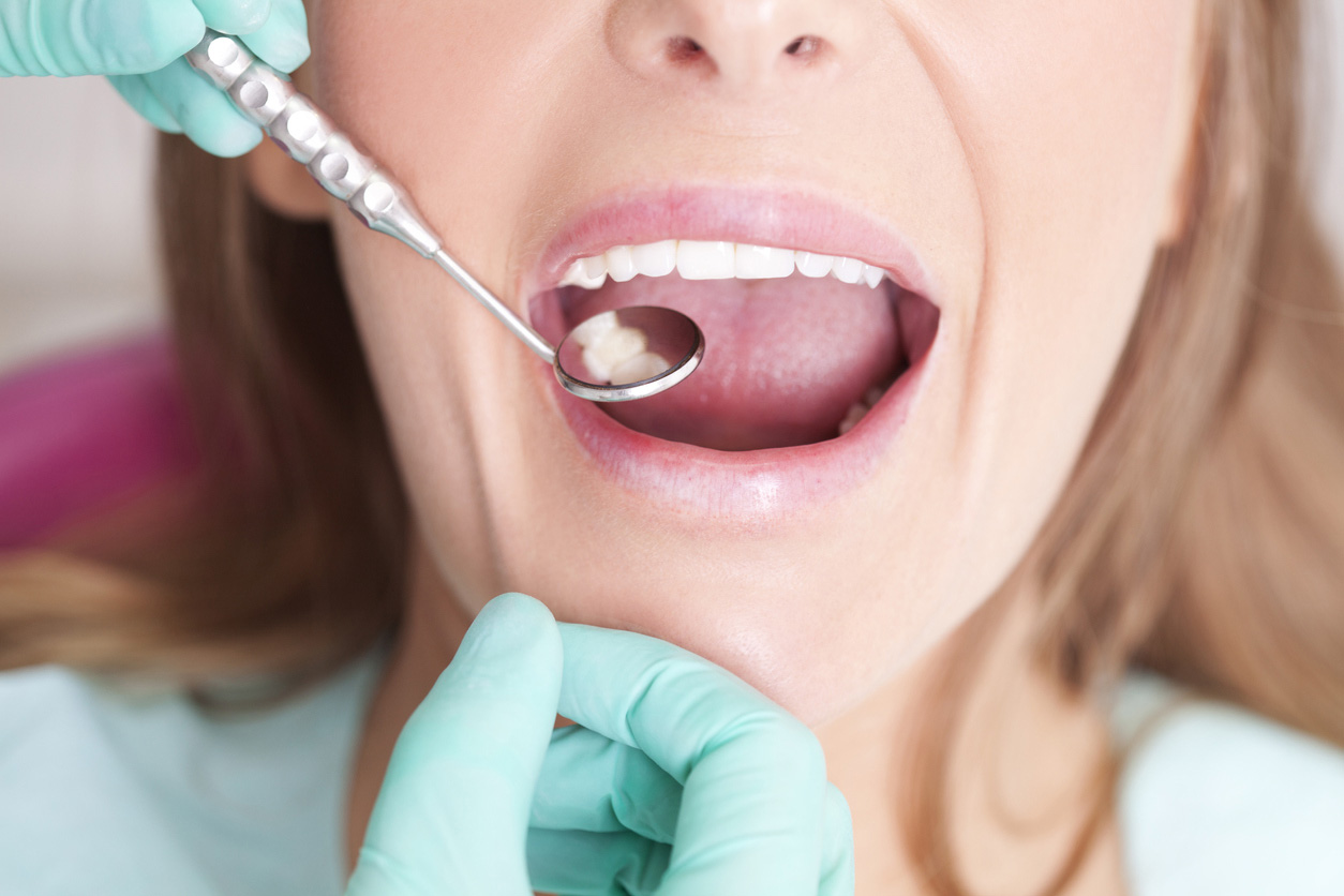 mouth sores