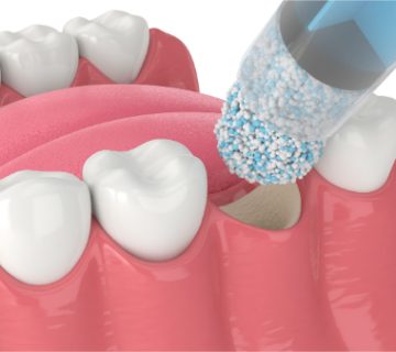 The use of hydrogels in bone tissue engineering