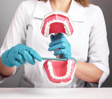 wisdom tooth extraction