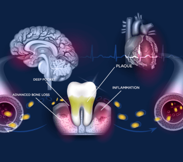 What diseases is oral health related to?