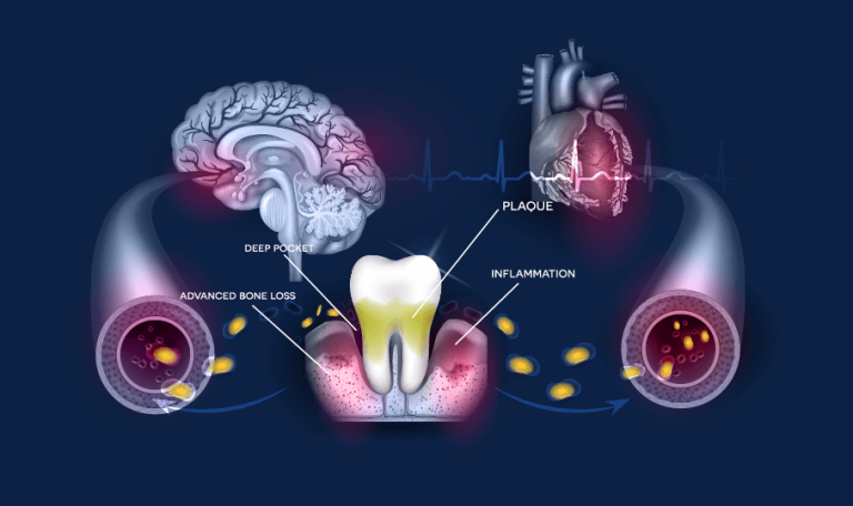What diseases is oral health related to?