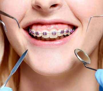 Oral hygiene in people with treatment