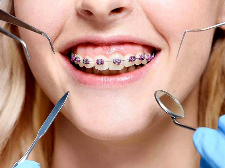 Oral hygiene in people with treatment