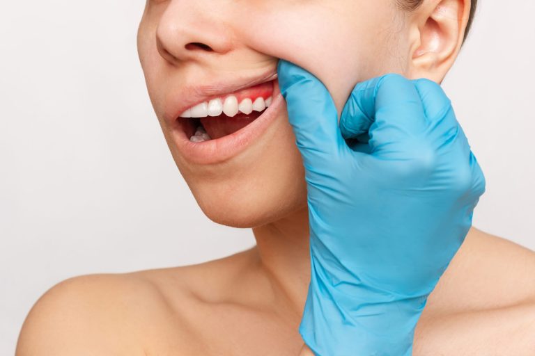 Preventing gum disease