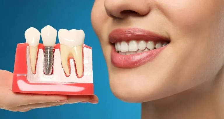 The best choice for dental implants in Karaj