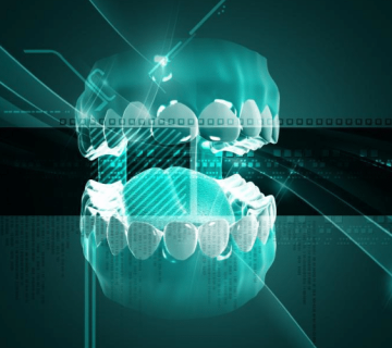 Digital implant