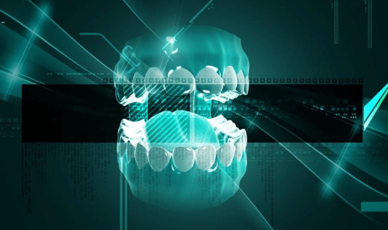 Digital implant