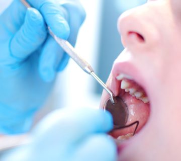 Caring for a damaged tooth