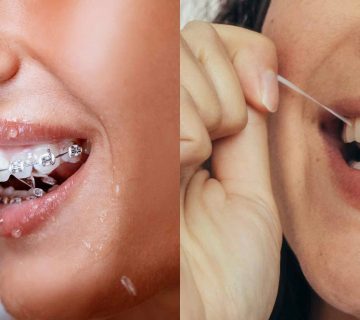 Comparison of Waterpik and Dental Floss