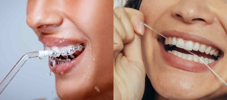 Comparison of Waterpik and Dental Floss