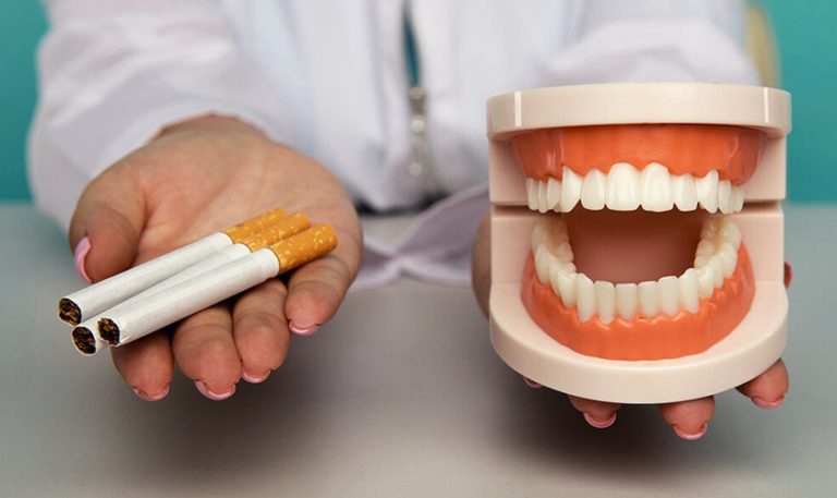 The effect of smoking on the success of dental implants
