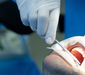 Common dental complications
