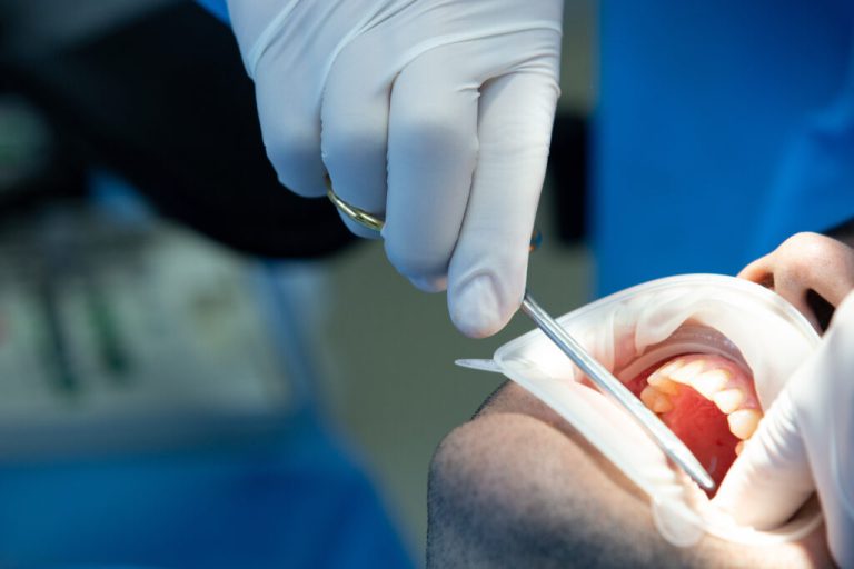 Common dental complications