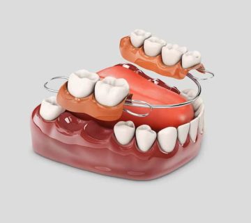 Dental prosthesis