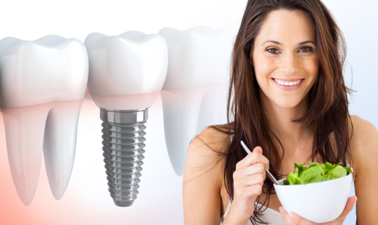 Post-implant care