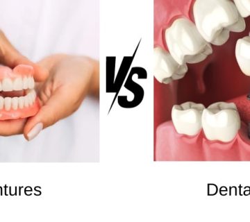 طول عمر ایمپلنت در مقایسه با دندان مصنوعی