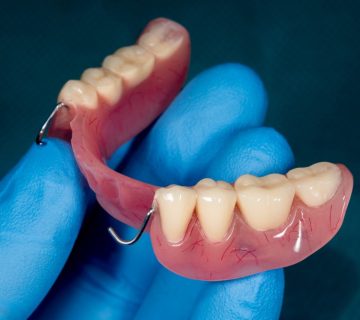 Comparison of acrylic and metal removable dentures